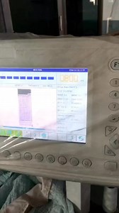 Galaxy 19 400 embroidery machine price Your Queries 👇 Galaxy 19 400 embroidery machine price galaxy embroidery machine galaxy machine galaxy 19 400 embroidery machine price in india galaxy 19 400 embroidery machine review galaxy embroidery machine price #galaxy #embroidery #machine #price #review #trendingshorts #trendingreels #trendingvideo #shortvideo #short #rpgroupofcompany | RP Group of Company 24×7