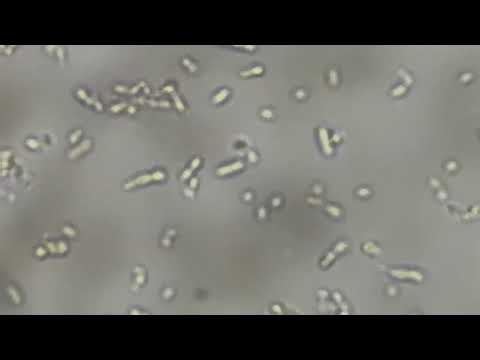 Motile Enterococcus under the microscope