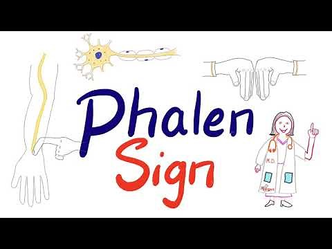 Phalen Sign (Phalen Test or Maneuver) Carpal Tunnel Syndrome | Clinical Medicine