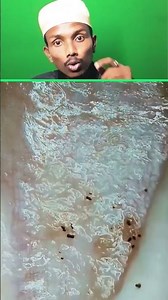 If you don't stop eating chicken, you will die 😱 #ytshorts #islamic #shortvideo #motivation #shor...