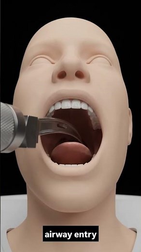 Emergency Intubation Step-by-Step: 3D Medical Animation Guide #science