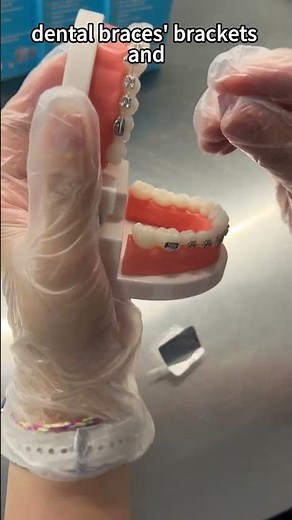 Orthodontic Protective Wax Usage Guide