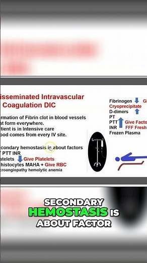 2-Minute DIC: Understanding Disseminated Intravascular Coagulation #shorts