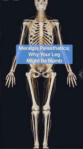 The Anatomy of Meralgia Paresthetica & Why You Don't Have Sciatica