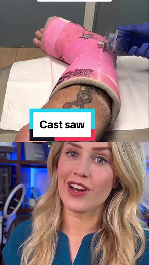 Cast Removal Prank Gone Wrong - Unexpected Twist!
