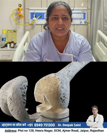 How long will Recovery time take Knee Replacement Surgery