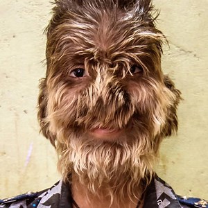 46M views · 161K reactions | A schoolboy in India has a rare condition that makes him look like a werewolf  | Born Different | Facebook