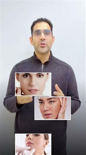 Permanent Mole Removal | Best & Safe Treatments