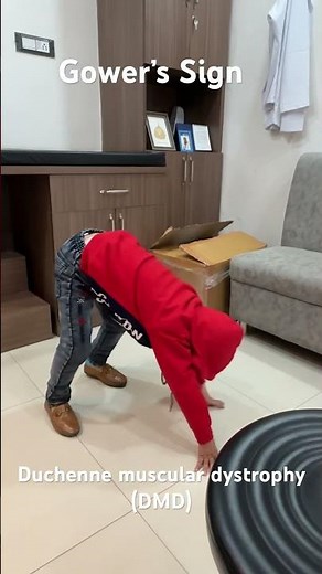 Gower’s Sign: Duchenne muscular dystrophy (DMD) #musculardystrophy #duchennemusculardystrophy