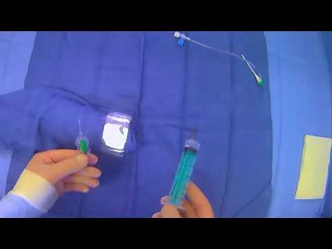 Removing The TR Band