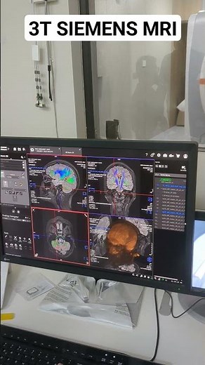 3T MRI SIEMENS #beginners #anatomy #mri #medicalimaging #radiology #medicalequipment #siemens
