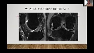 Intro to Knee MRI in Ten Minutes