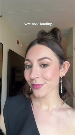 Rhinoplasty Recovery: Cast to Healed Results | Aeris Patient Journey by Dr. Ghersi