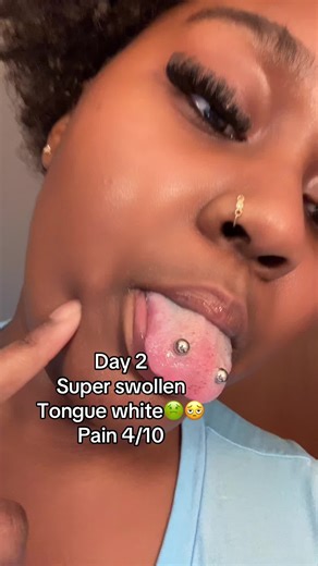 Had it before and woukd get it again😌 love frog eyes way better then snake eyes. Would get this piercing 1,000 times its so cuteeee i love it! Healing was only bad the first 3days then ur good #frogeyes #piercing