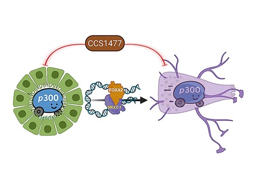 Prostate Cancer's Deadly Progression Revealed: A Pathway to Novel Treatments – Archyde