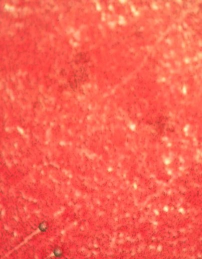 This is a drop of blood from a dog under our microscope. The three areas of movement that you see are microfilaria, or the larval stage of heartworms. These tiny worms will grow much larger and eventually lodge themselves into the major blood vessels of the heart and lungs ultimately causing heart failure. While this disease can be treated in dogs, treatment can be costly and uncomfortable for the patient. The disease can also affect cats but is untreatable. Heartworm disease is transmitted by t