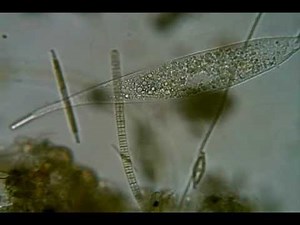 Trachelophyllid ciliate (possibly Trachelophyllum vestitum)