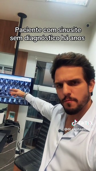 Sinusite de Origem Dentária: Causas e Tratamentos