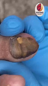 Natural Methods for Men Over 60 to Support Healthy Skin #FootWellness #HealthyHabits #FootSupport | Tots Mags Wheel