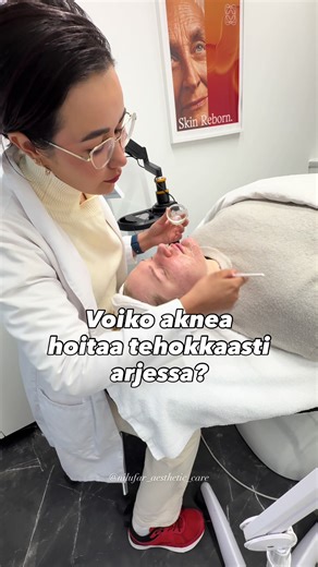 Kyllä! ✨ 1. Puhdistus – kaksi kertaa päivässä, mieto tensidi-puhdistaja. 2. Hapot – BHA/keratolyytit (salisylaatti) avatsee huokosia ja vähentää tukkeumaa.² 3. Valohoidot – sininen LED-valo voi vähentää bakteerien määrää ja tulehdusta.³ Tutkimuksissa keratolyyttiset hapot ovat vähentäneet mustapäitä ja papuleita merkittävästi verrattuna placeboon.² Ja LED-valohoidot voivat olla hyvä lisä, kun ihon punoitus on hallinnassa. ❣️Muista, että vahvat hoidot vaativat aina oikean rytmin ja suojan (SPF)! 