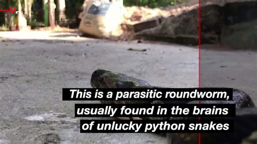 A live parasitic worm was surgically removed from a woman’s brain — and it’s a first in human history