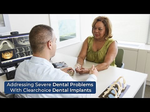 ClearChoice Dental Implants: A Life-Changing Fix for Severe Tooth Loss 🦷✨
