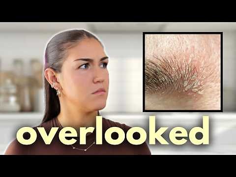 7 signs your body is low in iodine