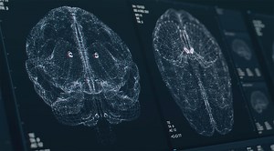 Calyx - Medical Imaging