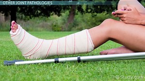 Joint Pathology - Video | Study.com