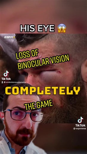 Impact of Binocular Vision Dysfunction in UFC Fight: Loss of Critical Functions