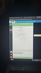 What structure is highlighted?A. Depressor labii inferioris m... | Filo
