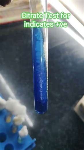 Citrate Test for Bacteria