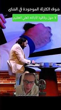تعالوا بقى نشوفوا الكارثه اللي في الشاي اللي احنا بنشربه بتسبب لنا ايه احنا كده جسمنا كله امراض😭😭
