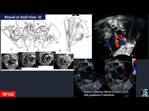 Atrial Septal Defect ( ASD & PFO )