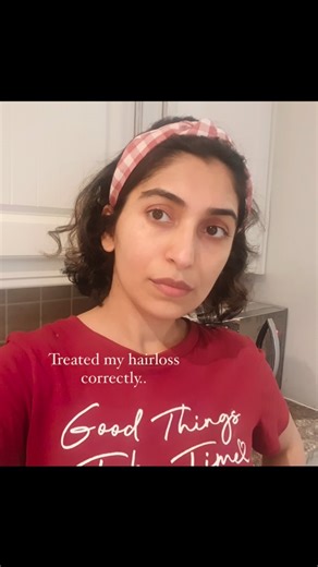 Sabin | Turning Hairloss Pain Into Power 🌿 on Instagram: "I used to stare at my bald patches, wondering if my hair would ever grow back. But just a few months in… I started seeing thick regrowth where there was once nothing. 🙏✨ This isn’t just luck — it’s the result of powerful changes, inside and out. If you’ve been struggling with hair loss, feeling hopeless or stuck, know this: your transformation is possible too. Join me on a journey to uncover the secrets, tips, and treatments that helped