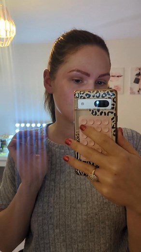 17K views · 73 reactions | Am I having an allergic reaction to the aloe Vera gel?  #aloeveragel #allergicreaction #redskin #eyebrows | Foodislife | Facebook