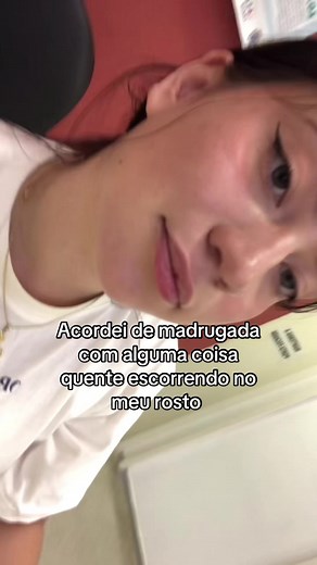 Derrame Ocular: Causas e Sintomas