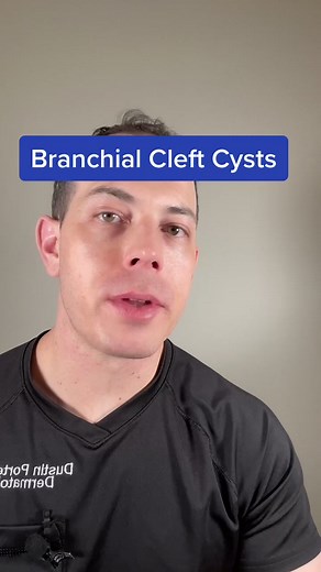 Identifying and Treating Branchial Cleft Cysts