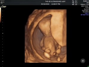 Go baby go!! #14weeks | The 4D Ultrasound Lady