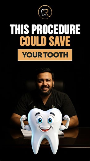 Muhammad Rizwan Nazeer on Instagram: "When saving a natural tooth is possible, why choose extraction? Molars hemisection is a conservative yet highly effective dental procedure that allows us to preserve a compromised tooth instead of removing it entirely. In cases where only one root of a molar is affected due to decay, fracture, or periodontal damage, hemisection enables precise removal of the damaged portion while retaining the healthy root and crown structure. With accurate diagnosis, advanc