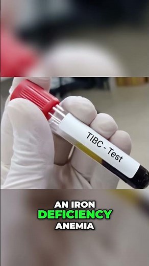 Iron Deficiency Anemia: The Truth Serum Iron & TIBC Reveal