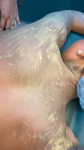 41 reactions · 3 comments | Herbal peel skin treatment for dark spots...