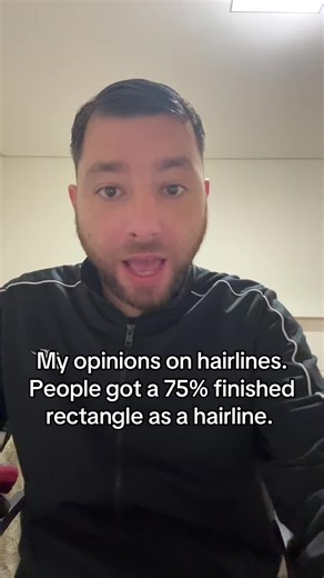 The Truth About Hairlines: Why Natural is Better