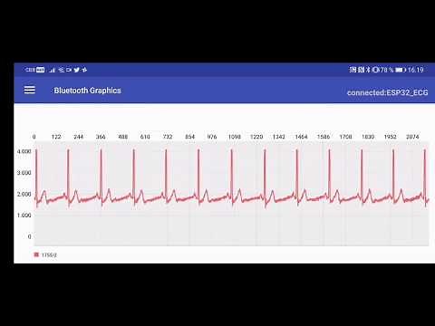 ESP32 AD8232 Arduino Bluetooth ECG (simple)