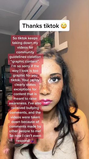 Addressing TikTok Account Ban Threats and Censorship