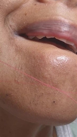 The Art of Hair Removal: Satisfying Threading Techniques