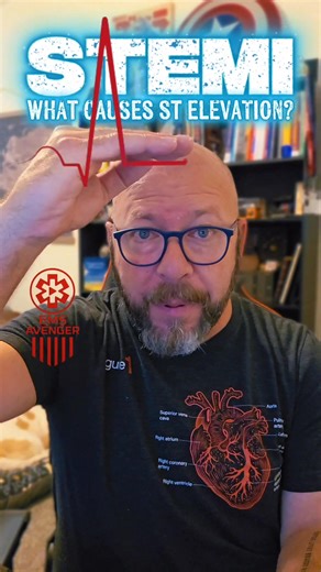 What causes the ST ELEVATION we see in the STEMI morphology? What anamoly is the monitor detecting? The thing is, it's really something that's kind of an accident based on what the monitor does when it doesn't detect current. So it's kind of a happy accident that we can use to raise our suspicion of myocardial infarction. #Paramedicbook #paramedicsoffacebook #medicsoffacebook #medicbook #emtsoffacebook #emsbook #Paramedic #paramedics #firstresponders #firstresponderbook #firstrespondersoffaceboo