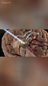 Cornell Built A Brain Implant Smaller Than A Grain Of Salt That Wirelessly Reads Your Brain