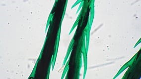 Berry Hair Whole Mount Magnified Under Laboratory Microscope 100x Against Bright Field Stock Footage - Video of ecology, detail: 260007508