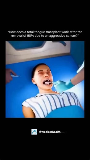 Medical & Health ⚕️ on Instagram: "🧠🩺 TOTAL TONGUE TRANSPLANT: HOW MEDICINE “REBUILDS” THE IMPOSSIBLE When someone loses a large portion of their tongue due to aggressive cancer, it’s not just an organ that’s affected. Speech, swallowing, breathing, and even personal identity are impacted. That’s exactly why modern reconstruction is so impressive: today, with advanced techniques, surgeons can create a new functional structure using the patient’s own tissue and reconnect everything with near-mi